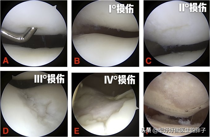 练体育膝盖疼怎么治